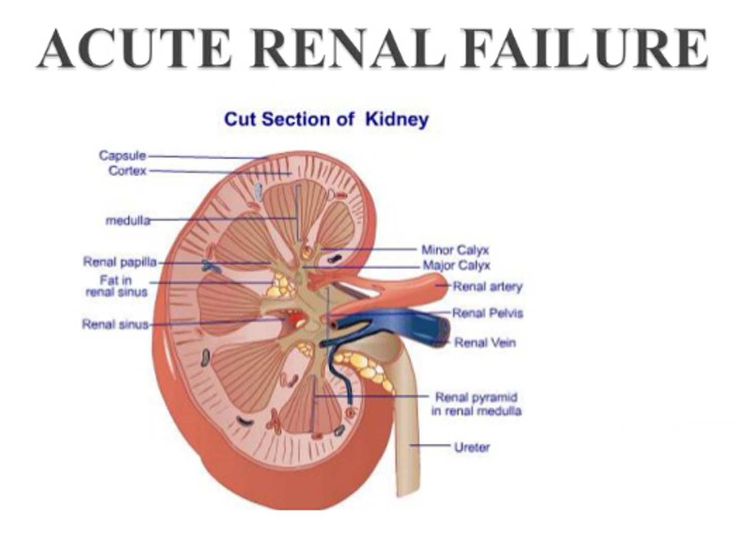 Acute Renal Failure Causes and Symptoms